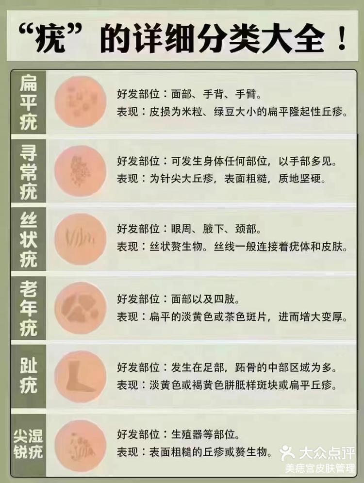 病毒疣怎么治能除根图片