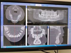 -Dr.Z dental仁康种植矫正中心