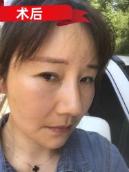 -素美医疗美容·西南眼鼻整形·修复基地