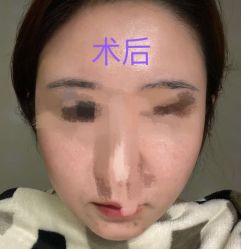 体验后-杭州医巢医疗美容