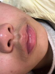 -薇兰专业脱毛连锁机构