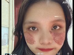 -重庆医科大学附属第一医院(本部)