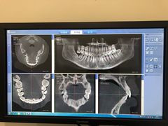-Dr.Z dental仁康种植矫正中心