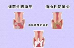 -邢台妇产医院