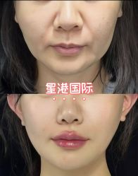 -星港国际·Skin皮肤专研·皮肤管理