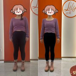 -Lily纤美·科技减脂中心