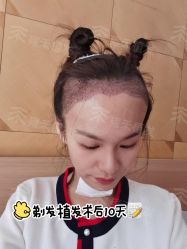 -雍禾植发全国连锁