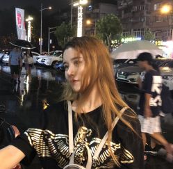 点击看大图 -大麦微针植发丨全国连锁