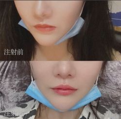 -上海漾颜医疗美容
