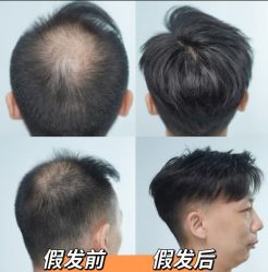 -唐风采假发补发定制