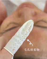 -瑶芳清颜草本祛痘