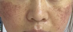 -纯粹医美