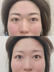 -西施无菌半永久纹绣眉眼影唇轻增发纹发际线