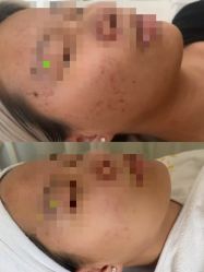 -康美贞·痘肌养护管理中心
