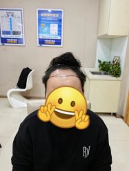 -大麦微针植发丨全国连锁