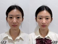 -Yestar重庆艺星医疗美容医院