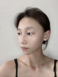 -四川米兰柏羽医学美容医院