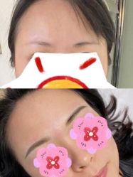 -Doris多里斯半永久纹眉·SMP纹发·发际线