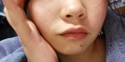 -痣缘宫