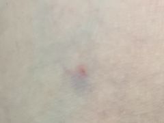 -中国人民解放军总医院