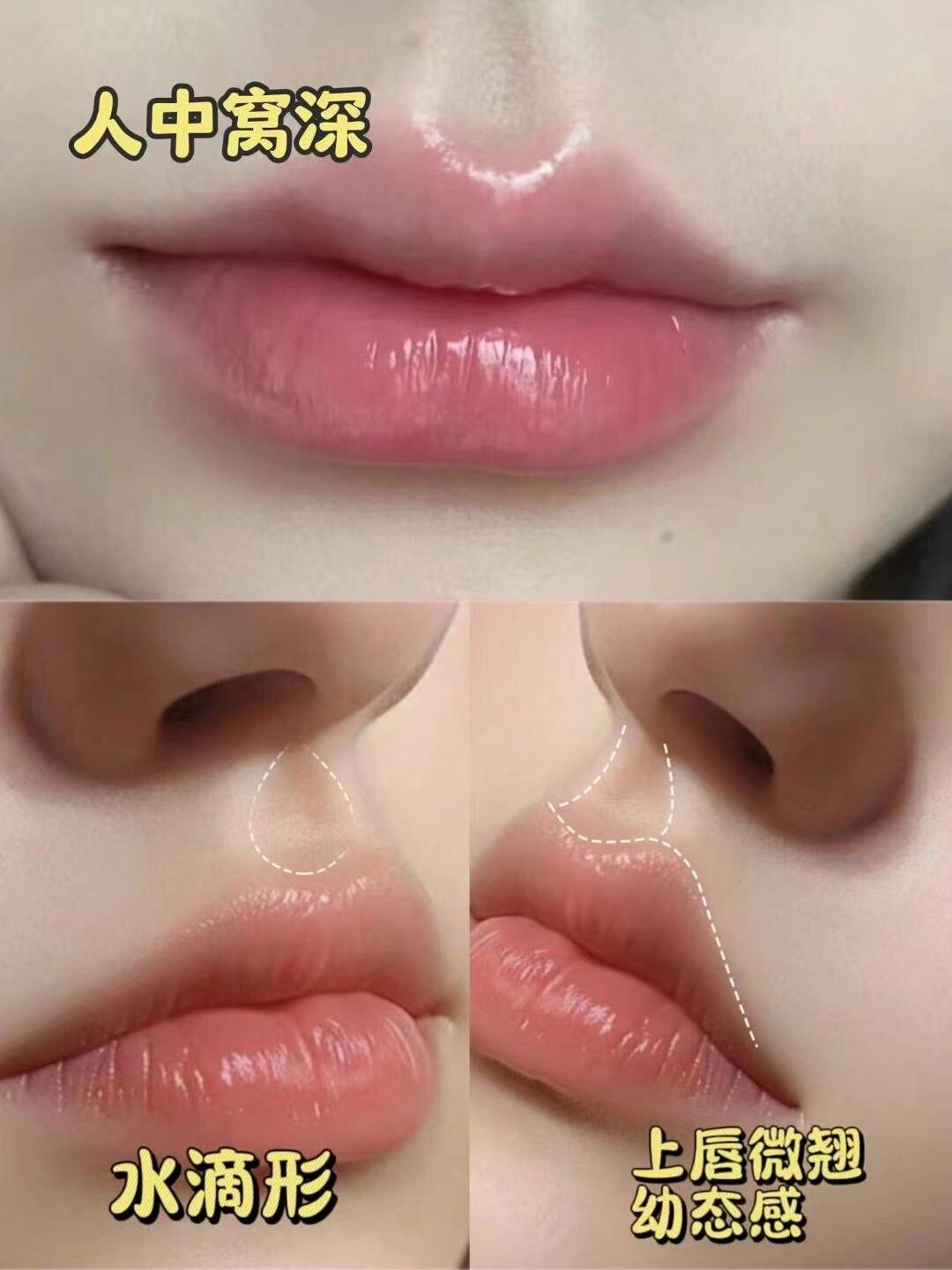 水滴型人中窝 少女感爆棚!