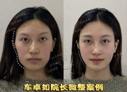 -Yestar重庆艺星医疗美容医院