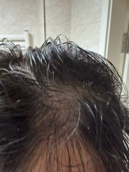 -熙朵美学植发·连锁品牌