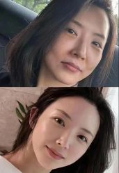 -Yestar 嘉兴艺星医疗美容医院