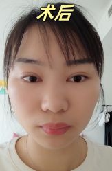 -素美医疗美容·西南眼鼻整形·修复基地