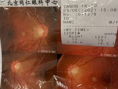 -首都医科大学附属北京同仁医院(西区)