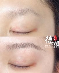 -德绣·机器野生眉发际线·美瞳线半永久