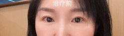 -八大处整形