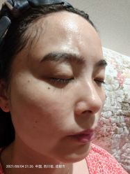 体验后-成都大华医学美容医院