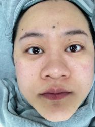 点击看大图 -SKIN79皮肤管理中心