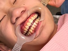 -齐玉齿科JADENTAL