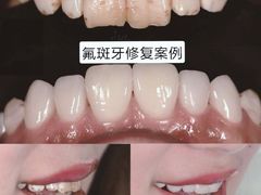 -团圆口腔·种植中心(锦江院区)