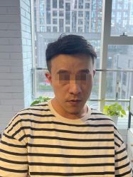 -极客侠男士假发定制补发