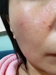 -北京美痣堂古方祛痣斑疣瘊