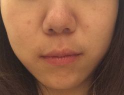 点击看大图 -TIME SPA科技美肤机构