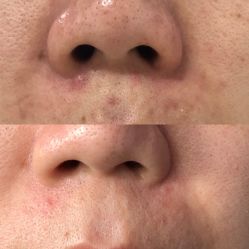 -夸迪QUADHA肌肤定制