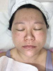 -苑苑vbeauty科技美容SPA