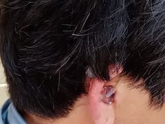 -海之声助听器无锡旗舰中心·儿童验配中心