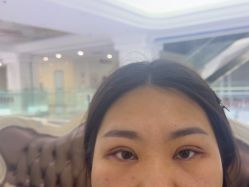 -西安壹加壹医疗美容·西北抗衰旗舰店