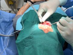 -爱贝口腔·牙周诊疗·种植修复中心