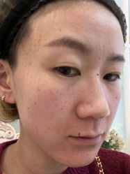 体验前-云南吴氏嘉美医疗美容医院