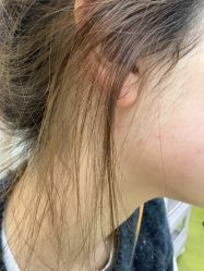 -Yestar宁波艺星整形医院