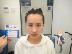 -大麦微针植发丨全国连锁