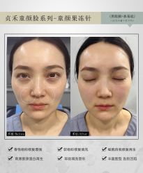 -贞禾医美·连锁