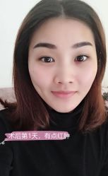 -天津健丽·去眼袋医疗美容机构