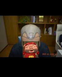 -大麦微针植发全国连锁